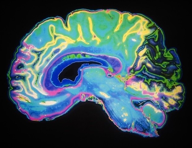 Scientists uncover a direct pathway for transport of inhaled wonderful particles from lungs to the mind