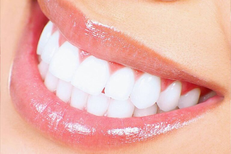 Best Dental Health Supplements for Healthy Teeth & Gums