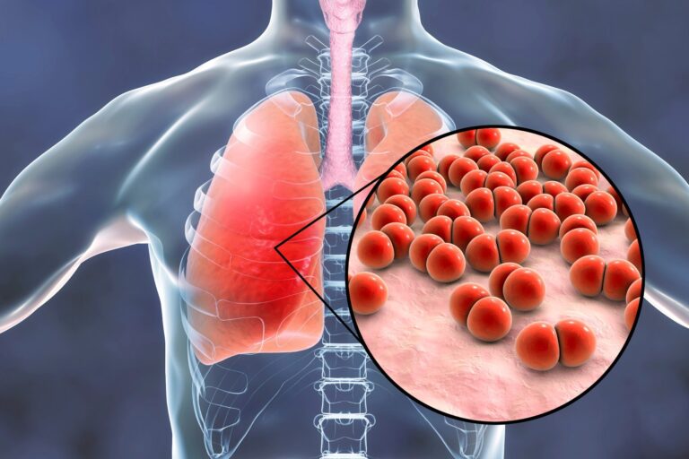 Study appears to be like at pneumococcal carriage amongst over 60’s throughout COVID pandemic