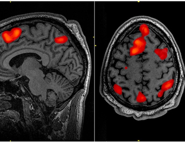 Study reports the results of gender and age on each ‘state’ and ‘trait’ fatigue