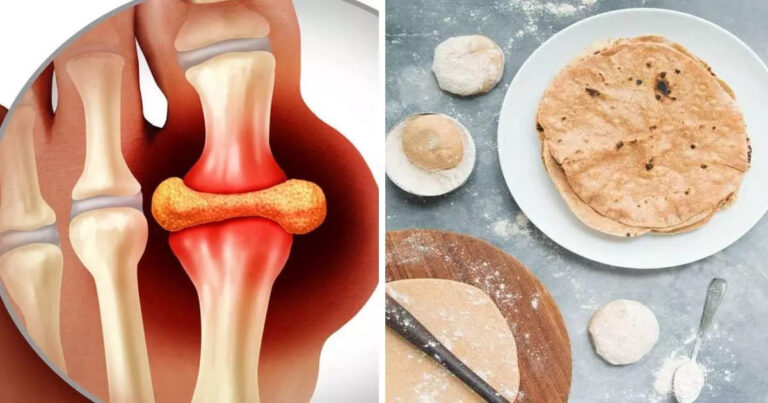 Diet suggestions for Uric Acid: It’s best to have this flour roti, uric acid will reduce immediately, joint pain will even go away – consultant nutritionist and dietitian suggest jawari ka atta or sorghum flour to cut back uric acid naturally