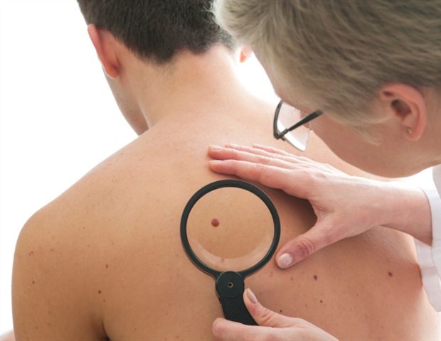 Research uncovers novel predictors of immune checkpoint inhibitor therapy for melanoma