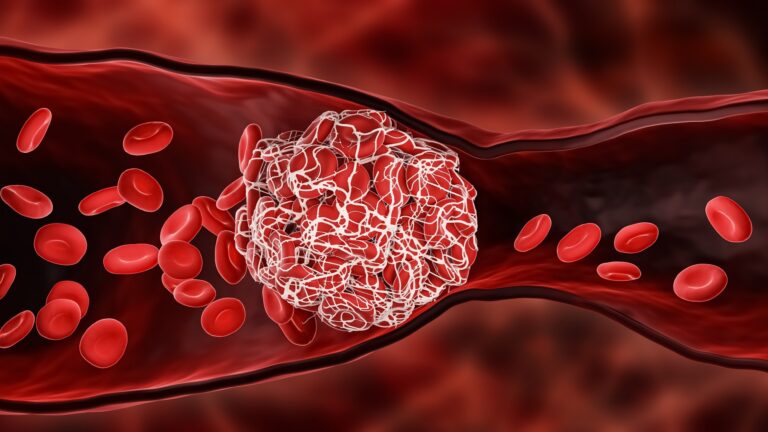 Amplification of venous thromboembolism risk by COVID-19 amongst malignancy patients