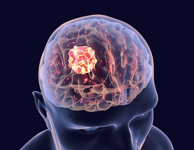 Newly identified gene may provide a therapeutic goal for deadly glioblastoma multiforme