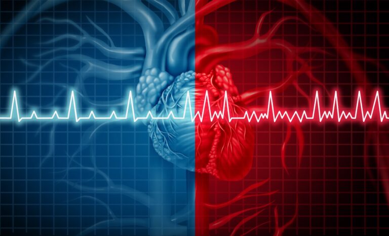 Sudden cardiac death risk may be determined by genetic rating