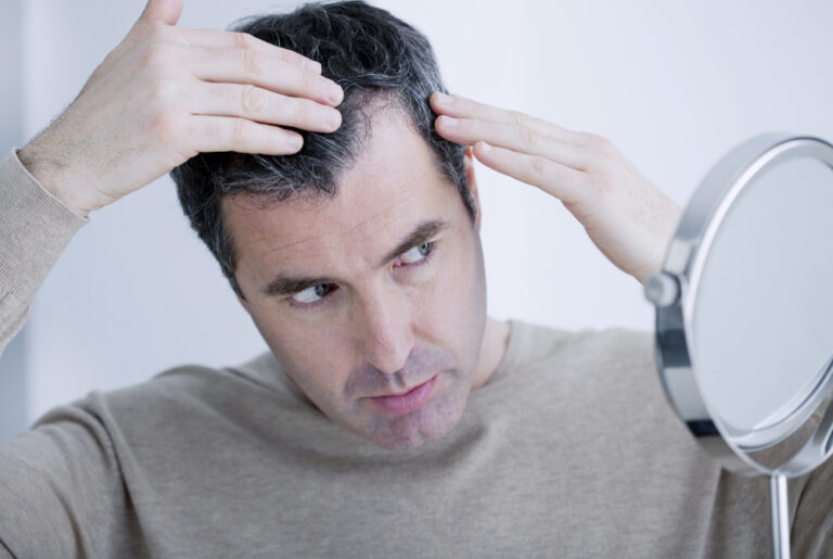 Drinking Soda Usually Found To Cause Hair Loss In Men