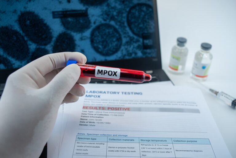 Summarizing the evidence of respiratory transmission of mpox