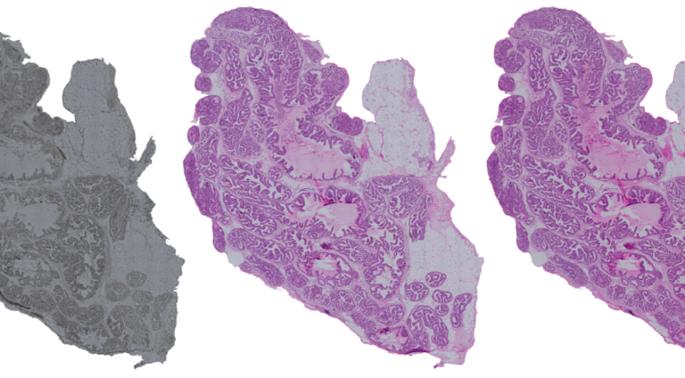 Latest AI-based method for virtual staining of histopathological tissue samples