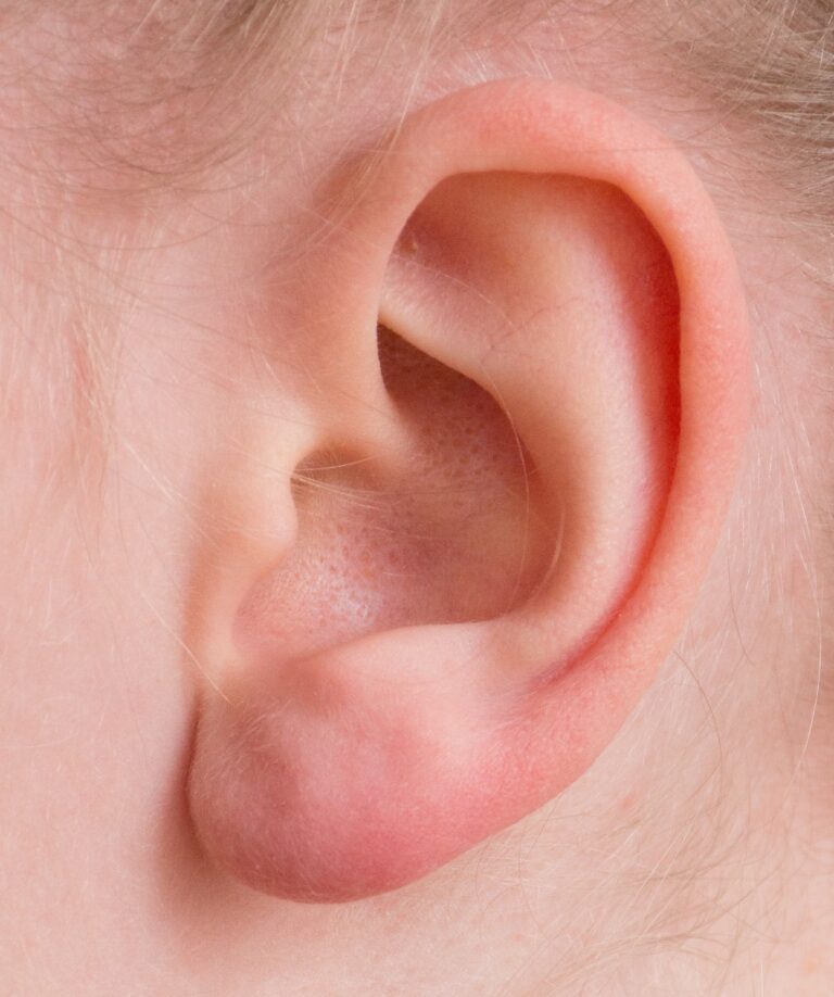 Sharp Pain In The Ear May Be Indicative Of These 5 Health Problems