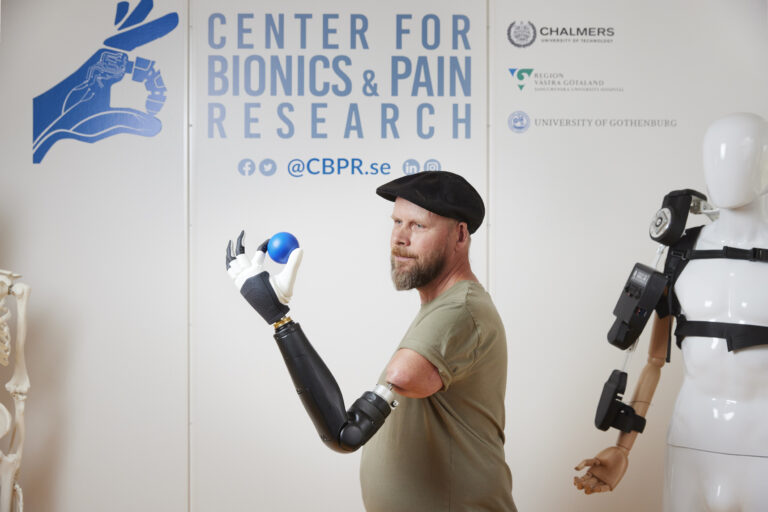 Prosthetic Breakthrough Allows Man With Amputated Arm Move Every Finger Of His Bionic Hand