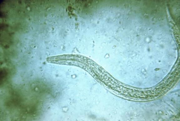 Hookworms Can Improve Insulin Resistance In Diabetes Patients, Clinical Trial Shows