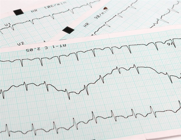 Latest software automates evaluation of calcium release events